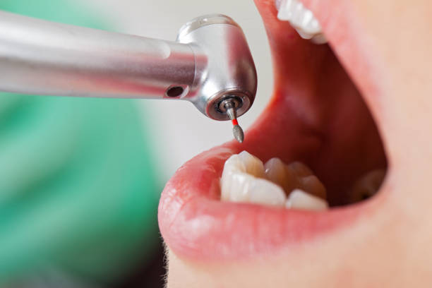 Best Dental Abscess Treatment in Redwood, OR
